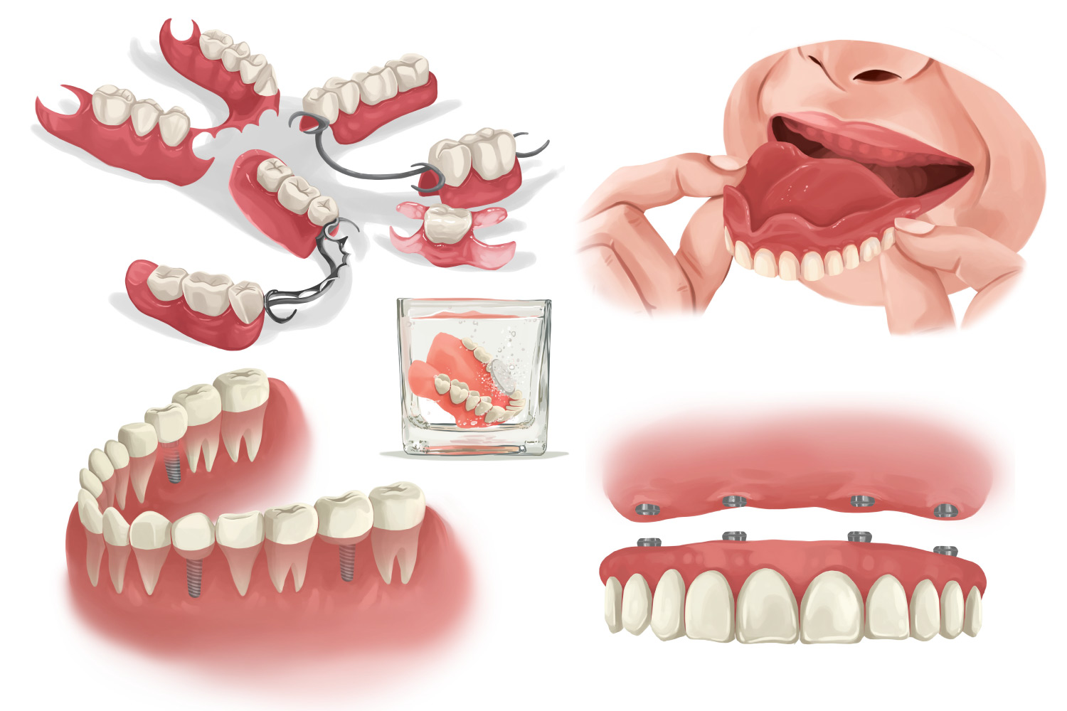 Several illustrations of partial dentures, full dentures, and dental implants to replace missing teeth